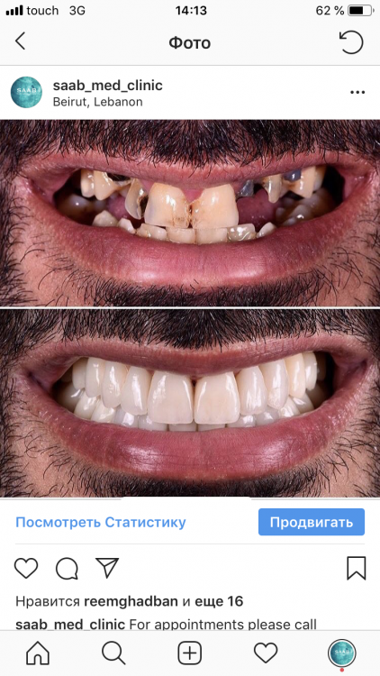 338846B0-0606-45AA-8BAF-2DF1B0289929.png